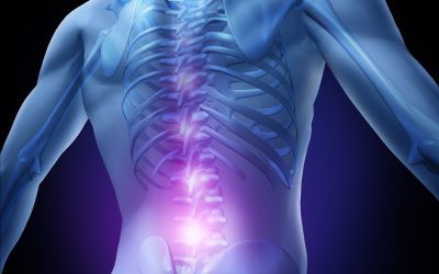 Prepping Your Home for After Orthopaedic Spine Surgery in Boca Raton, FL