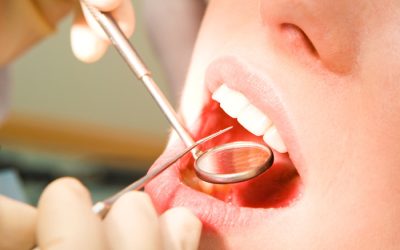 Family Dentistry In New Baltimore MI Is Proven To Prevent Some Oral Health Concerns