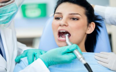 Signs You Need to See a Dentist in Kelowna